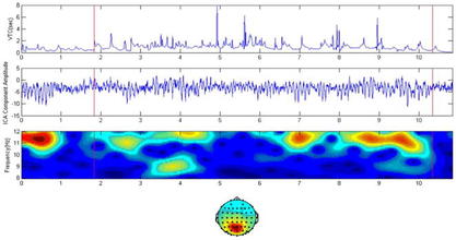 EEG image